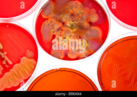 Petri dishes holding different stages of bacteria cultures Stock Photo
