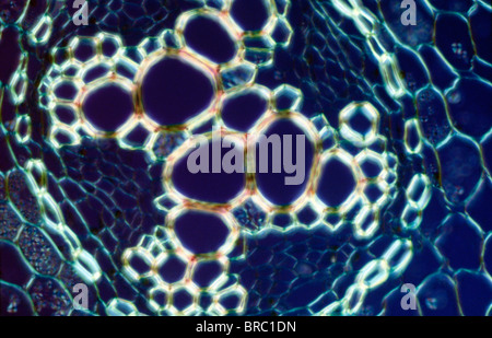 Light Micrograph (LM) of a transverse section showing xylem of root of Ranunculus repens (Creeping Buttercup) Stock Photo