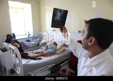 x-rays of wounded civilians in Afghanistan Stock Photo