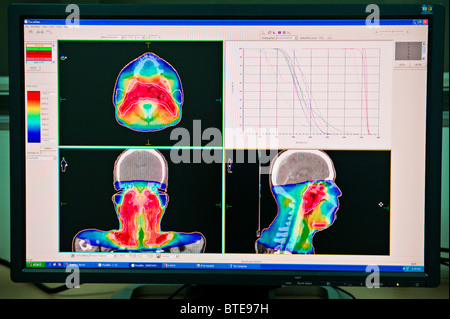 Computer monitor in hospital oncology department showing CT images Stock Photo