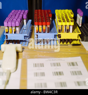 Blood samples bar code scanner on the tray of pre-analytical system ...