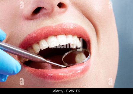 Close-up of open mouth during oral checkup at the dentist’s