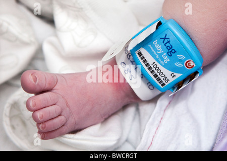 Baby security tag to prevent child abduction from maternity wards in Hospitals Stock Photo
