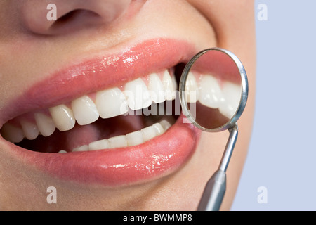 Close-up of patient’s healthy smile with mirror near by Stock Photo