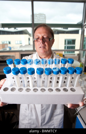 Dr.David Prichard holding Scientific specimen capsules containing parasite Hookworm University of Nottingham. Photo:Jeff Gilbert Stock Photo