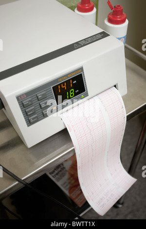 heart rate testing machine