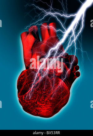 Heart attack, conceptual artwork Stock Photo