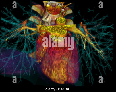 3D CT scan of the human heart Stock Photo