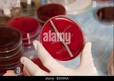 bacteria culture by swab Stock Photo - Alamy