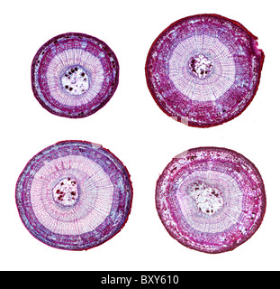 Light micrographs of basswood (Tilia americana) stems in cross section. One-year through three-year specimens. Stock Photo