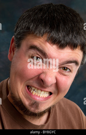 Man grits his teeth with a painful expression. Stock Photo