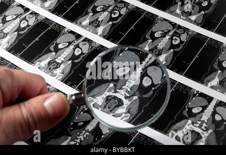 Multi-slice computed tomography, magnetic resonance imaging, MRI examination of the internal organs Stock Photo