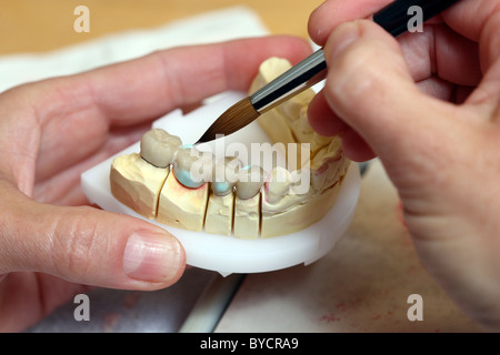 Dental laboratory, dental technician at work, making of tooth bridges, tooth prosthesis, health care. Stock Photo