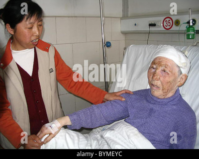 HEADACHE FROM HELL A Chinese grandmother suffering persistent headaches ...