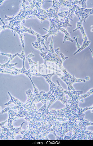 Microscope view of Prostate Cancer cells in tissue culture showing walls and nucleus. Stock Photo