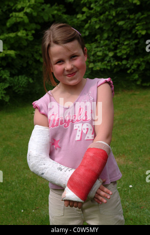 Little girl with two broken arms Stock Photo