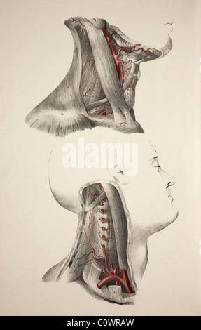 Neck arteries. Historical illustration showing two images of the human head with dissected necks revealing the neck arteries. Stock Photo