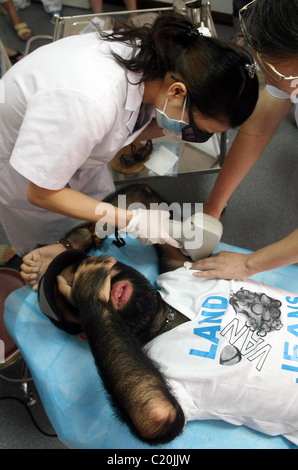 IT'S HAIR TODAY, GONE TOMORROW... The world's hairiest man bristles as he prepares for surgery - to smooth out his skin. Yu Stock Photo