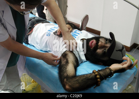 IT'S HAIR TODAY, GONE TOMORROW... The world's hairiest man bristles as he prepares for surgery - to smooth out his skin. Yu Stock Photo