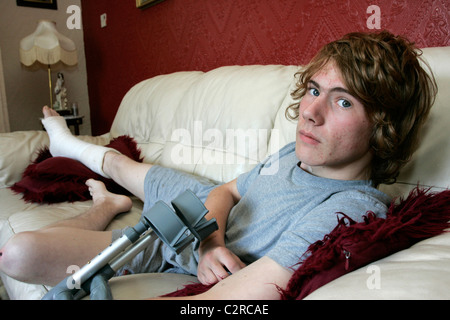 Broken leg cast hi-res stock photography and images - Alamy