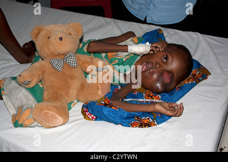 Young African boy with severe symptons of Burkitts cancer Coast Hospital Mombasa Kenya Stock Photo