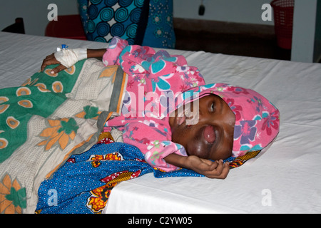 Young African boy with severe symptons of Burkitts cancer Coast HospitaL Mombasa Kenya Stock Photo