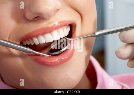 Close-up of patient’s open mouth during oral checkup with mirror and hook