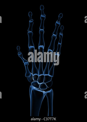 x-ray hands - arthritis Stock Photo