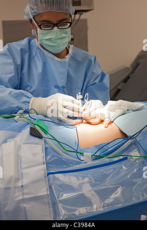 Detroit, Michigan - Dr. Robert Morris makes incisions in a cancer in preparation for robotic surgery at St. John Hospital. Stock Photo