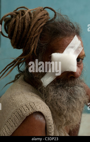 Bihar India March 2011. Akhand Jyoti Eye hospital, Mastichak . Sadhu (holy man) with eye patch after cataract operation Stock Photo