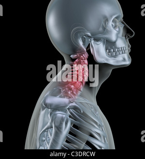 3D render of a skeleton with neck bones highlighted Stock Photo