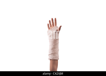 broken hand in cast on white background Stock Photo