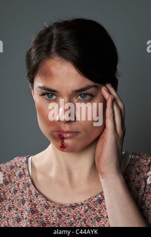 A woman with bruises and bloody lip Stock Photo