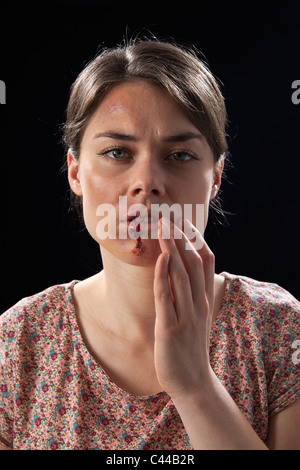 A woman with bruises and bloody lip Stock Photo