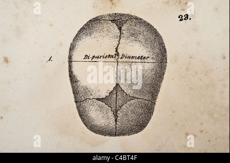 Cranium illustration of fetus circa 1844 Stock Photo