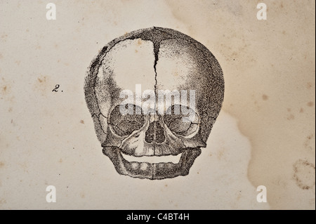 A skull illustration of fetus circa 1844 Stock Photo