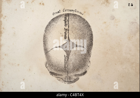 A skull fontanel illustration of fetus circa 1844 Stock Photo