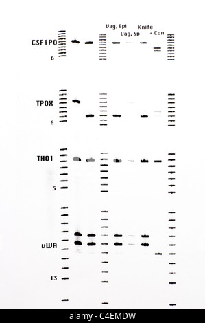 Forensic DNA results with STR analysis of samples. Stock Photo