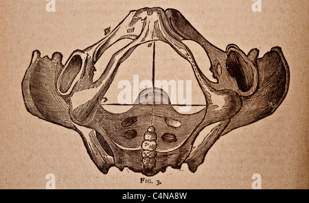 Antique medical illustration of a pelvic bone Stock Photo