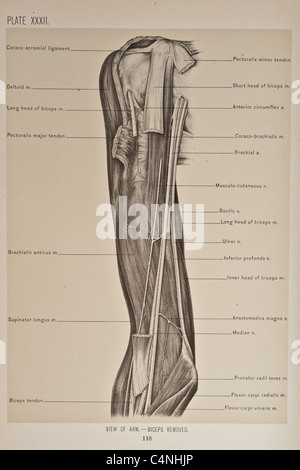 Illustration of Human Arm copyright 1899 Stock Photo