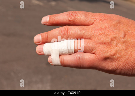 A close up of a mans hand showing a bandage and a dislocated finger trying to heal Stock Photo