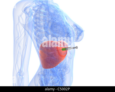 Liver injection Stock Photo