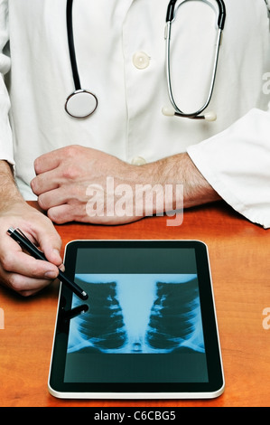 Doctor Using a Digital Tablet to Examine a Chest X Ray. Stock Photo