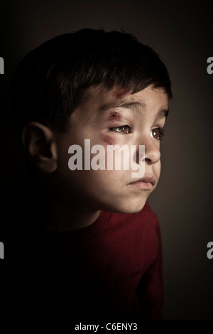 Mixed race boy with scrapes on his face Stock Photo