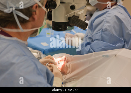 Ophthalmologist performing cataract surgery Stock Photo