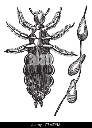 Head lice or Head louse, vintage engraving. Old engraved illustration of Head lice isolated on a white background. Stock Photo