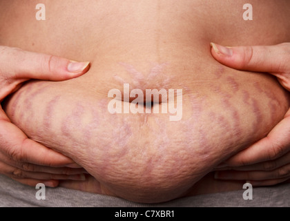 40+ Muffin Top Stomach Stock Photos, Pictures & Royalty-Free