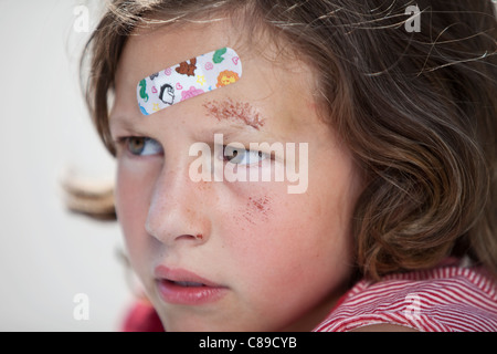 Germany, Bavaria, Wounded girl sitting on road after bicycle accident, close-up Stock Photo