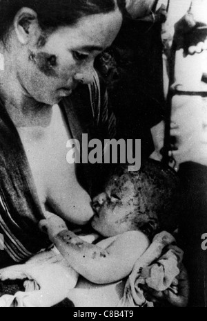 mother and son after the atomic explosion in Nagasaki,1945 Stock Photo