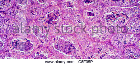 The testes Stock Photo: 13186178 - Alamy